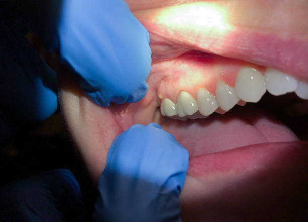 Best Emergency Gum Pain Relief  in Thompsons Station, TN